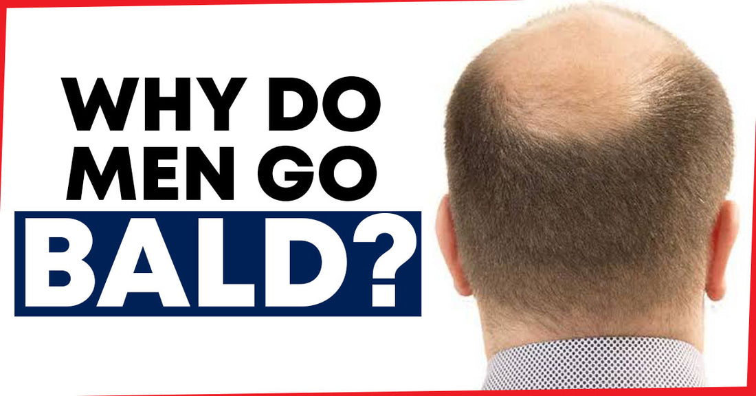 When Do Men Bald? Understanding the Timeline and Triggers