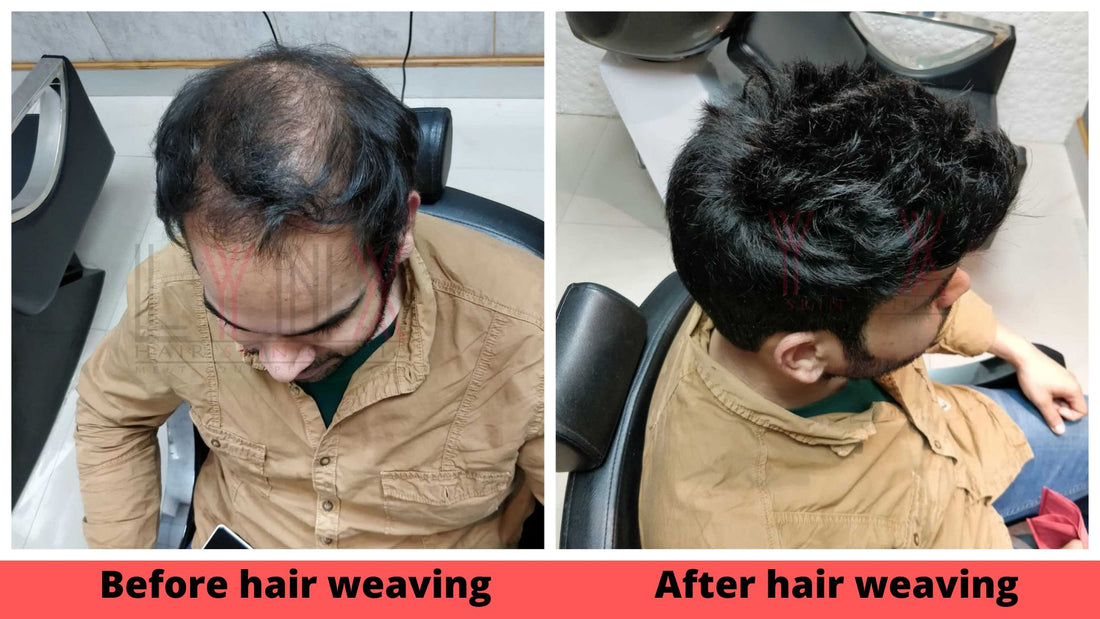 Common Issues with Hair Weaving: How to Identify and Solve Them