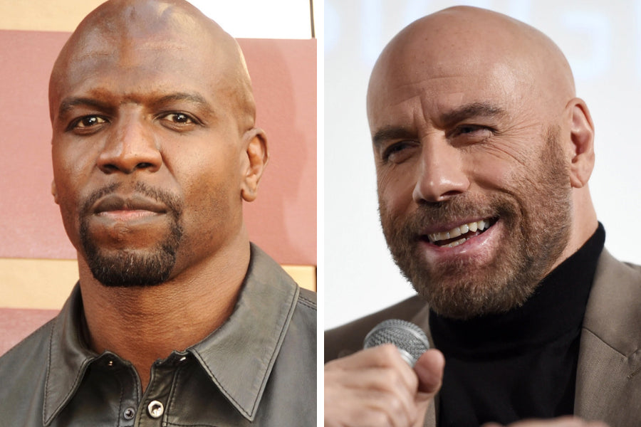 Celebrity Bald Style Icons: How Top Stars Rock the Bald Look