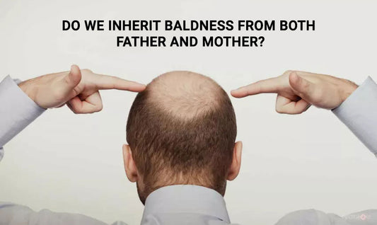 Tracing the Origins of the Baldness Gene: Is it Inherited from Mom or Dad?